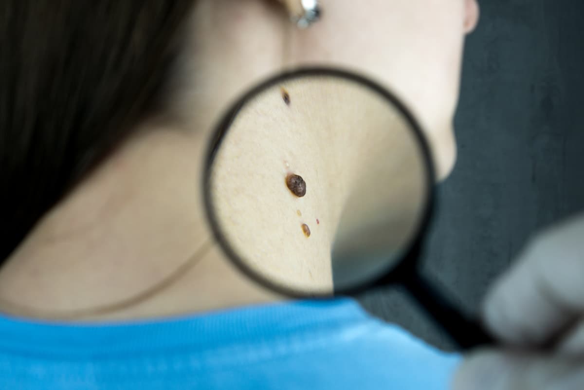 Dermatologia Clínica